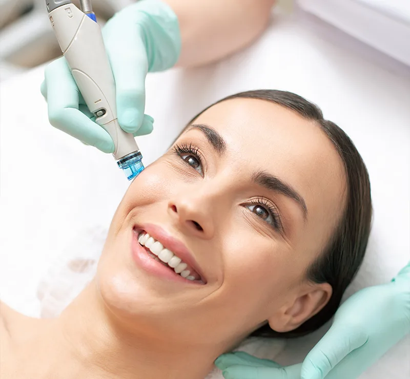 Tratamientos Faciales