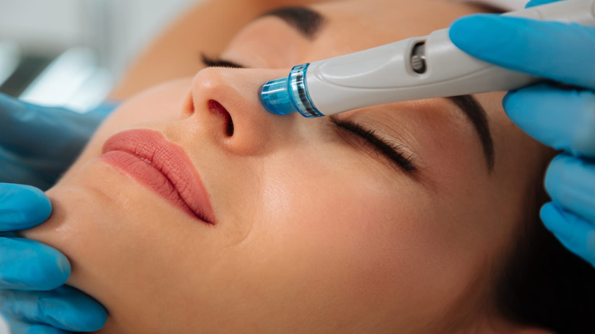 Estética y medicina estética en A Coruña Tratamientos Faciales